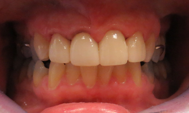 North Orange Family Dentistry - After